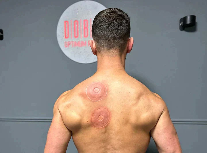 THE ONLINE SPAβ’οΈ Acupuncture SmartCup