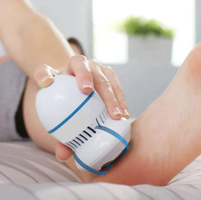 THE ONLINE SPA™️ Vacuum Callus Remover