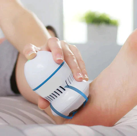THE ONLINE SPA™️ Vacuum Callus Remover